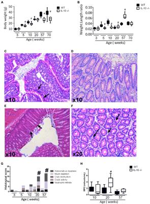 Akkermansia deficiency and mucin depletion are implicated in intestinal barrier dysfunction as earlier event in the development of inflammation in interleukin-10-deficient mice